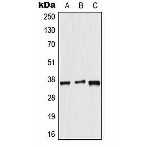 ALX3 Rabbit Polyclonal Antibody