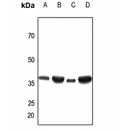ANT3 Rabbit Polyclonal Antibody