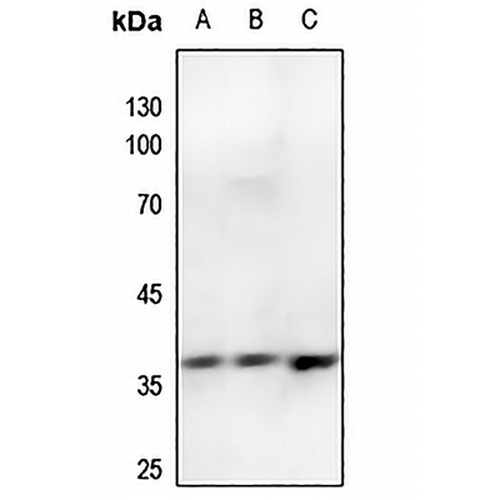 Annexin A2 (Phospho-S26) Rabbit Polyclonal Antibody