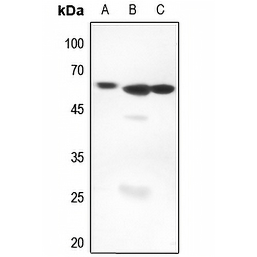 AIRE Rabbit Polyclonal Antibody