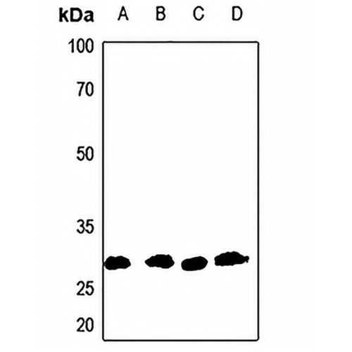 Aquaporin 1 Rabbit Polyclonal Antibody