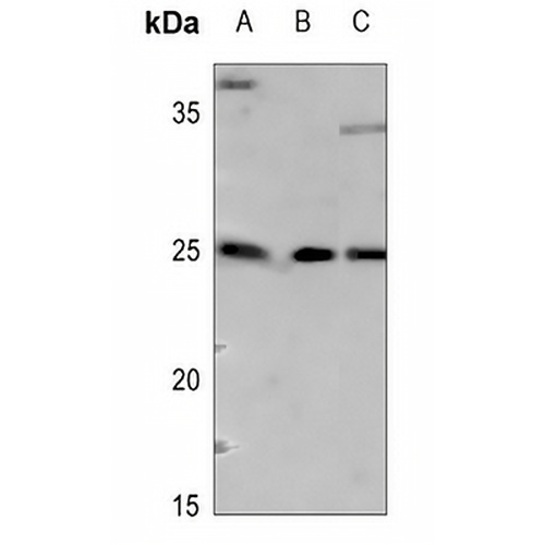 ARF4 Rabbit Polyclonal Antibody