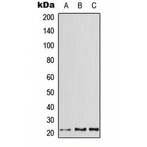 ATF3 Rabbit Polyclonal Antibody