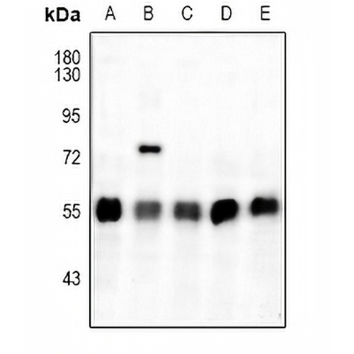 ATF4 (Phospho-S245) Rabbit Polyclonal Antibody