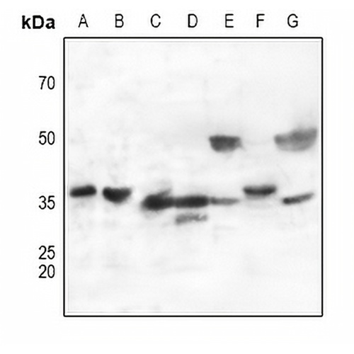 CD298 Rabbit Polyclonal Antibody