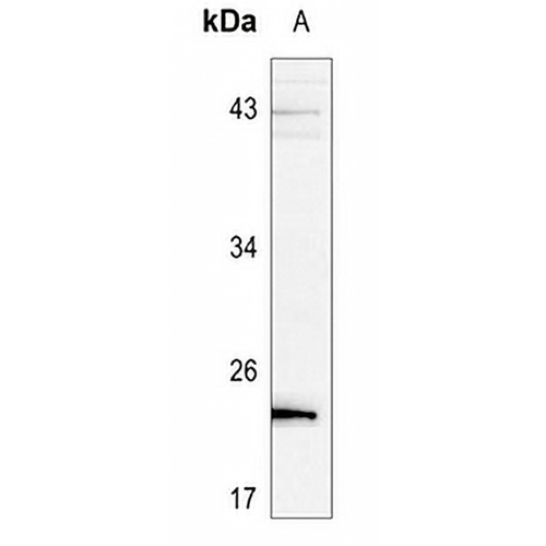 BAD (Phospho-S136) Rabbit Polyclonal Antibody