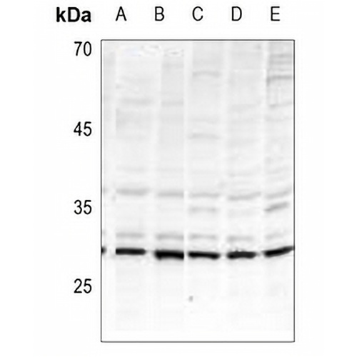 BIK (Phospho-T33) Rabbit Polyclonal Antibody