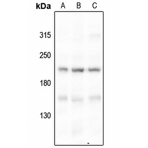 BRCA1 (Phospho-S1524) Rabbit Polyclonal Antibody