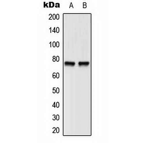 BTK (Phospho-Y551) Rabbit Polyclonal Antibody