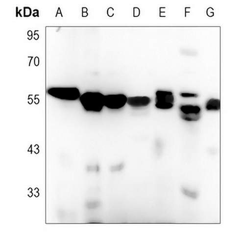 Calreticulin Rabbit Polyclonal Antibody