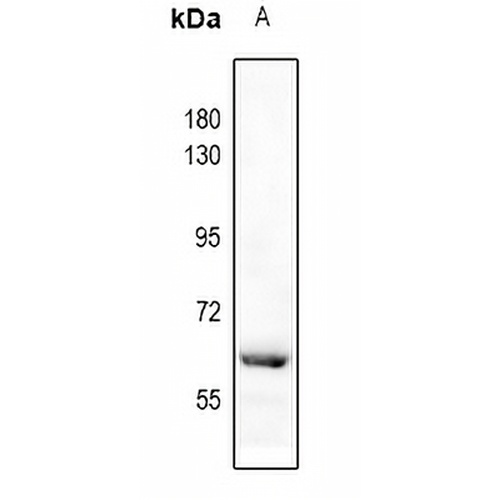 Catalase (Phospho-Y386) Rabbit Polyclonal Antibody