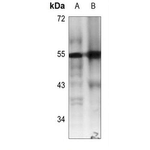 RUNX1 Rabbit Polyclonal Antibody