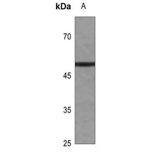 Cyclin E1 Rabbit Polyclonal Antibody