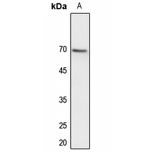 CDC25B Rabbit Polyclonal Antibody