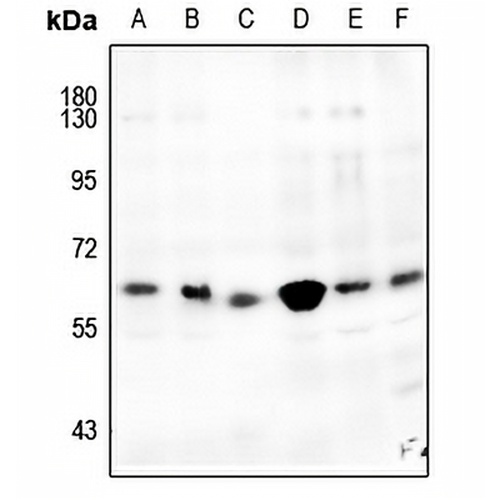 CDK8 Rabbit Polyclonal Antibody