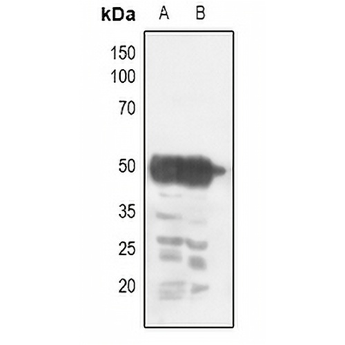CHRNA1 Rabbit Polyclonal Antibody