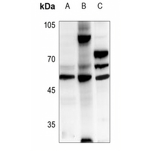 CKMT2 Rabbit Polyclonal Antibody