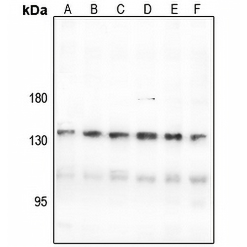 CNGB1 Rabbit Polyclonal Antibody