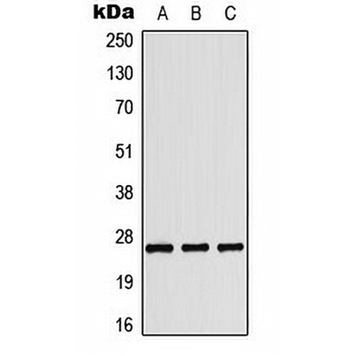 Tumstatin Rabbit Polyclonal Antibody