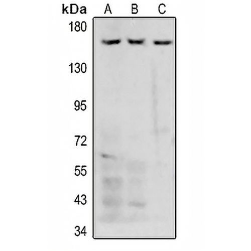 Collagen 4 alpha 5 Rabbit Polyclonal Antibody
