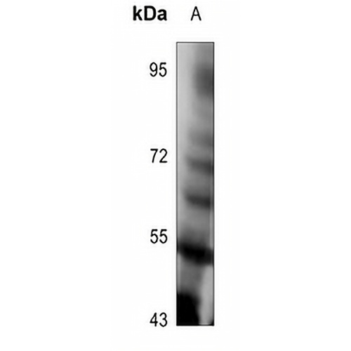 TPL2 (Phospho-T290) Rabbit Polyclonal Antibody