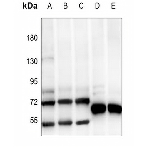 ATF2 Rabbit Polyclonal Antibody