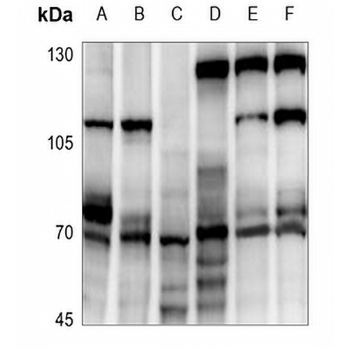 ATF2 Rabbit Polyclonal Antibody
