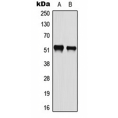 ATF2 (Phospho-S112) Rabbit Polyclonal Antibody