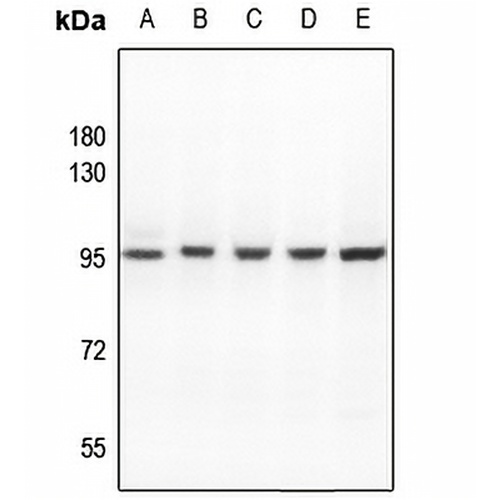 ATF6B Rabbit Polyclonal Antibody