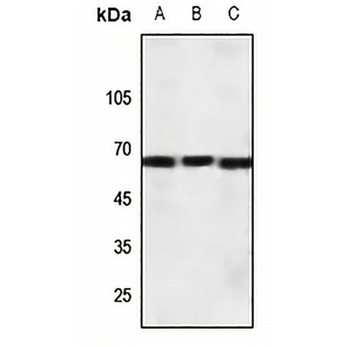 CRHR1 Rabbit Polyclonal Antibody