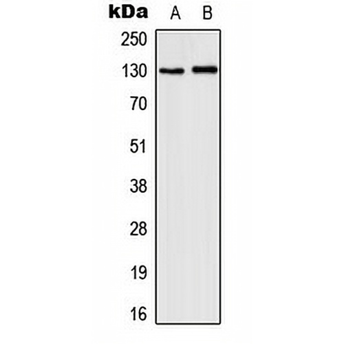 CD131 (Phospho-Y593) Rabbit Polyclonal Antibody