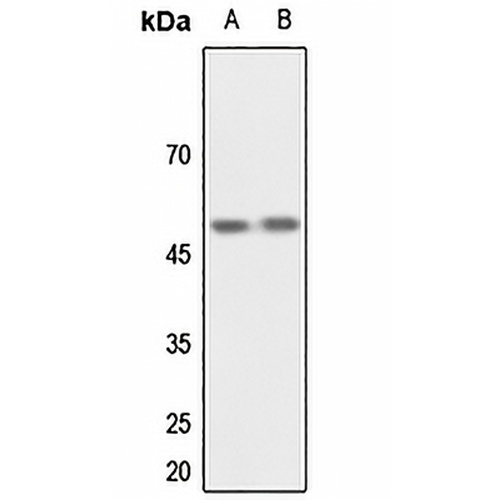 CSK Rabbit Polyclonal Antibody