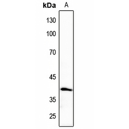 CK1 alpha Rabbit Polyclonal Antibody