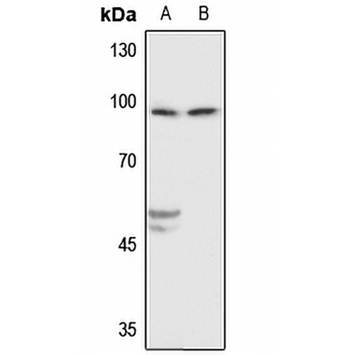 Beta-catenin Rabbit Polyclonal Antibody