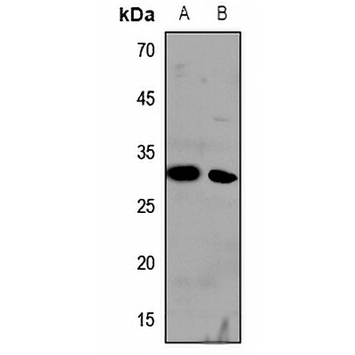Cathepsin H Rabbit Polyclonal Antibody