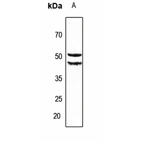 Cytochrome P450 2A6 Rabbit Polyclonal Antibody