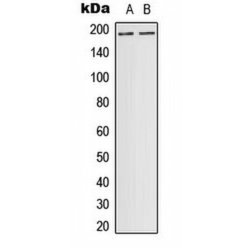 DCC Rabbit Polyclonal Antibody