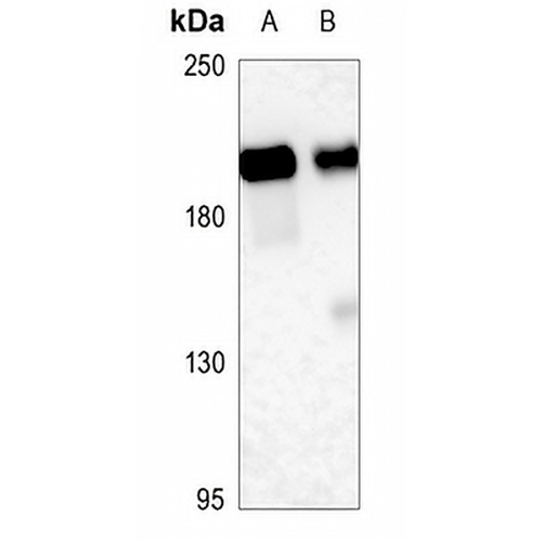 CD143 Rabbit Polyclonal Antibody