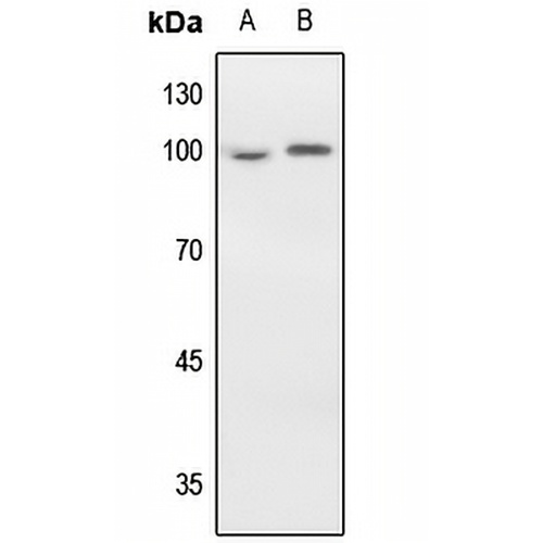 EEF2 Rabbit Polyclonal Antibody