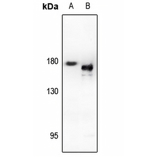 EGFR Rabbit Polyclonal Antibody
