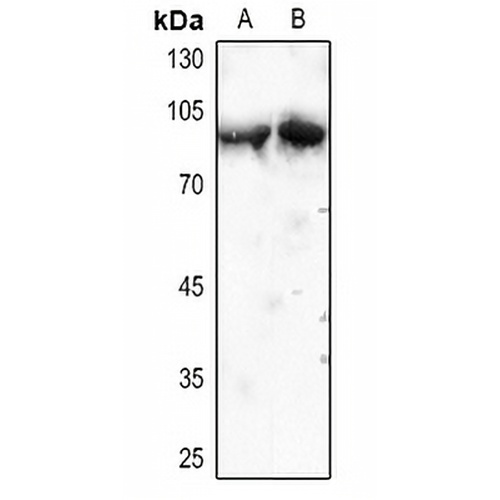 Cortactin Rabbit Polyclonal Antibody