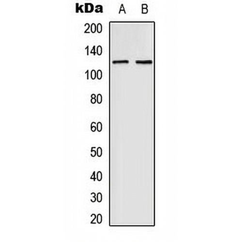 EPHB4 Rabbit Polyclonal Antibody