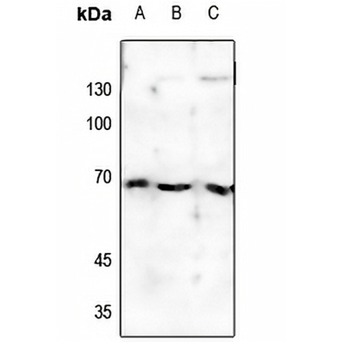 Estrogen Receptor alpha (Phospho-S118) Rabbit Polyclonal Antibody