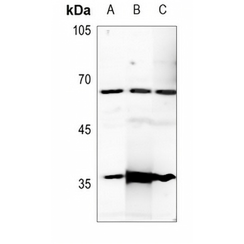 Estrogen Receptor alpha Rabbit Polyclonal Antibody