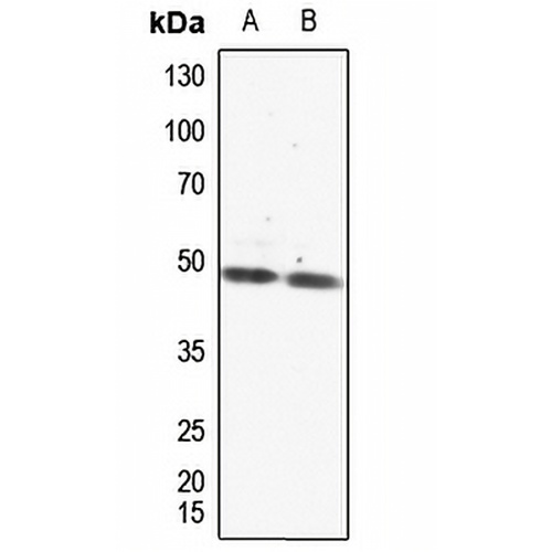 PAR1 Rabbit Polyclonal Antibody