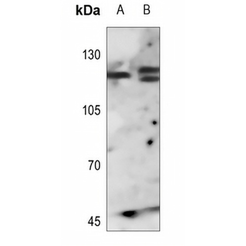 FGFR1 Rabbit Polyclonal Antibody