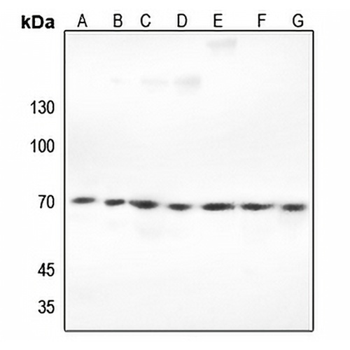 Ku70 Rabbit Polyclonal Antibody