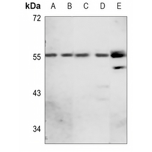 GABRA1 Rabbit Polyclonal Antibody