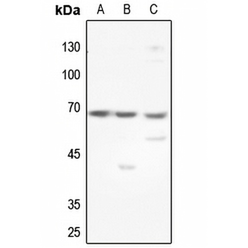 GCKR Rabbit Polyclonal Antibody