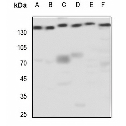 mGLUR5 Rabbit Polyclonal Antibody